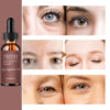 Eye Essence Oil Can Reduce Fine Lines, Tighten Skin And Improve Damaged Skin