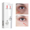 Eyes Cream Dark Circles Fading Eye Bags Eye Hyaluronic Acid Moisturizing Serum Against Puffiness Eye Care Gel