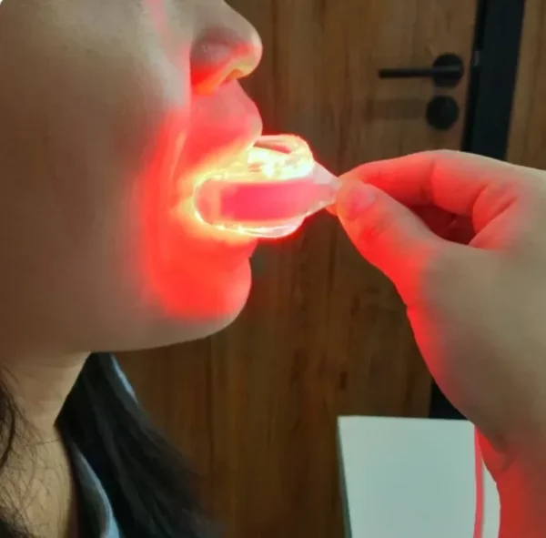 Dental Equipment Teeth treatment, oral hygiene portable Kit, Oral Fresh Tooth Care