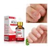 Beauty Health Relaxation Treatment Nail Fungal Treatment Serum Onychomycosis Paronychia Anti Infection Toe Fungus