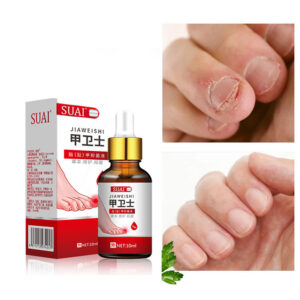 Beauty Health Relaxation Treatment Nail Fungal Treatment Serum Onychomycosis Paronychia Anti Infection Toe Fungus