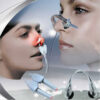 Therapy Machine Allergy Reliever Low Frequency Laser Hay Fever Sinusitis Treatment Device Nose Care Massager Machine