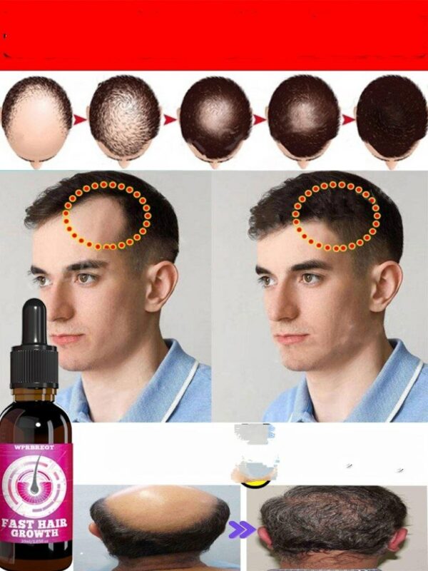 Natural Ginger Essential Oil Fast Hair Growth Anti Hair Loss Treatment Prevent Baldness Nourish Fast Growth Dry Damaged