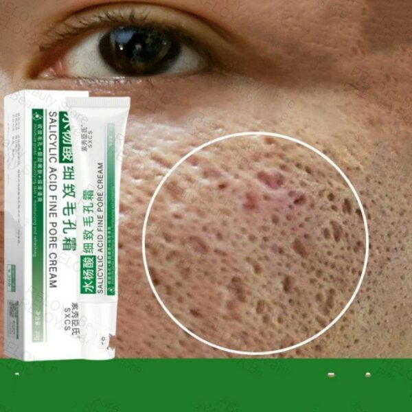 Fast Repair Facial Redness Cream Sooth Itching Sensitive Skin Improve Rosacea Remove Acne Nourish Facial Skin Korean Cosmetics