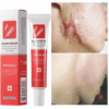 Effective Scar Removal Cream Treatment Stretch Marks Burn Surgical Scar Ointment Acne Spot Repair Gel Whitening Smooth