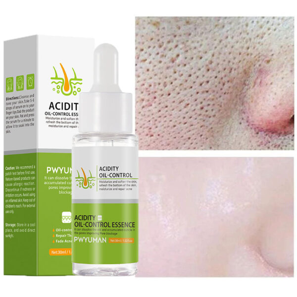 Face Serum Remove Blackheads Acne Oil Control Repair Essence Moisturizing Nourish Pores Firming Facial Care