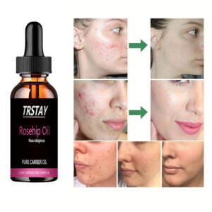 Rosehip Seed Oil Natural Anti Aging Treatment For Face Skin