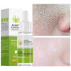 Face Serum Remove Blackheads Acne Oil Control Repair Gel Moisturizing Nourish Pores Firming Beauty Care
