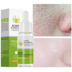 Face Serum Remove Blackheads Acne Oil Control Repair Gel Moisturizing Nourish Pores Firming Beauty Care