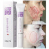 Anti-acne Cream Pore Shrink Oil Control Whitening Repair Pimple Deep Cleaning Moisturizer Firming Face Korean Skin Care Product