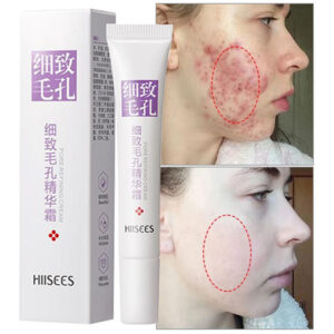 Anti-acne Cream Pore Shrink Oil Control Whitening Repair Pimple Deep Cleaning Moisturizer Firming Face Korean Skin Care Product