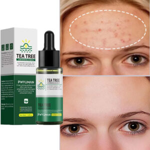 Tea Tree Acne Removal Face Serum Effective Anti-Acne Spots Scar Repair Treatment Moisturizing Whitening Oil Control Skin Care