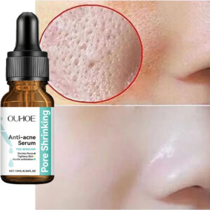 Remove Large Pores Serum Peeling Facial Pore Shrinking Tighten Repair Blackheads Anti Acne Moisturizing Firming Smooth Skin Care