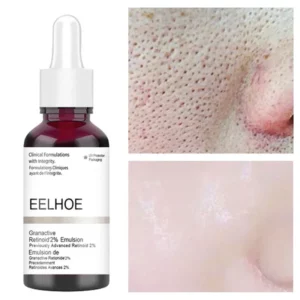 Salicylic Acid Fruit Acid Shrinking Pore Essence Exfoliating Moisturizing Whitening Nourishing Oil Control Pore Repair Essence
