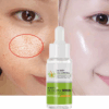 Acidity Pore Shrink Face Serum Remove Blackheads Acne Oil Control Repair Essence Moisturizing Nourish Pores Firming Facial Care