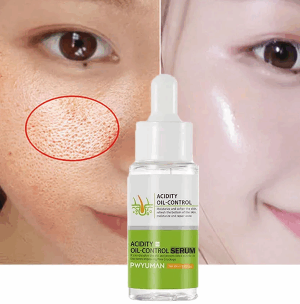 Acidity Pore Shrink Face Serum Remove Blackheads Acne Oil Control Repair Essence Moisturizing Nourish Pores Firming Facial Care
