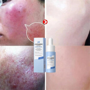 Instant Repair Redness Serum Relief Red Blood Itching Improve Rosacea Shrink Pore Oil Control Moisturizing Sooth Facial Care