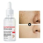 Whitening Freckle Serum Remove Melasma Dark Serum Whitening C Nicotinamide Spots Kojic Face Acid