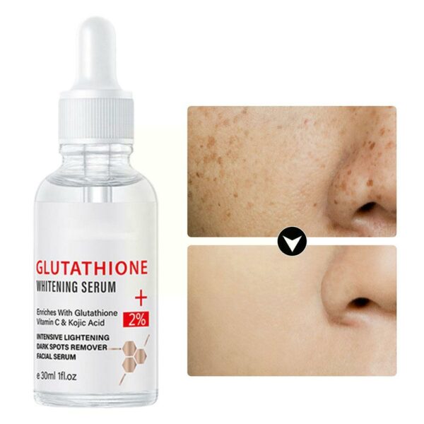 Whitening Freckle Serum Remove Melasma Dark Serum Whitening C Nicotinamide Spots Kojic Face Acid