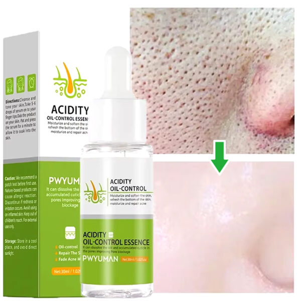 Acid Shrink Pores Facial Serum Moisturizing Purifies Pores Care Relieve Dry Acne Repair Firm Smooth Skin Beauty Cosmetics