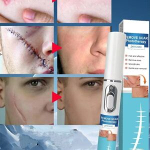 Portable blue light laser scar removal