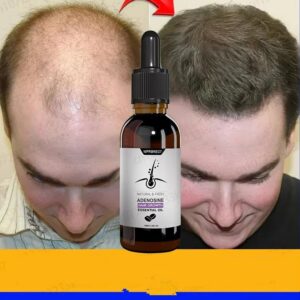 Cares For Men's And Women's Hair, Restores Hair And Activates Hair Follicles