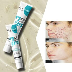 Acid Anti-Acne Gel Acne Removal Cream Remove Pimple Blackhead Treatment Shrink Pore Oily Control Skin Care