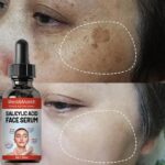 Niacinamide Lasting Nourishing Facial Salicylic Acid Serum For Sensitive Skin Moisturizing Face Skin Repair Care Product