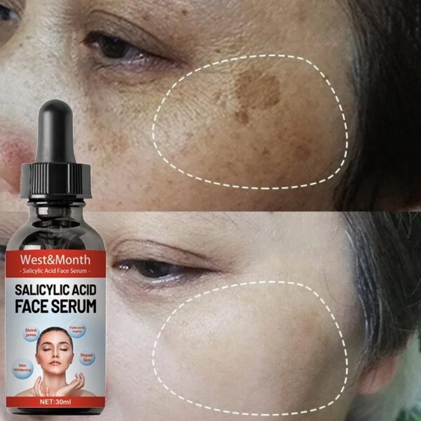 Niacinamide Lasting Nourishing Facial Salicylic Acid Serum For Sensitive Skin Moisturizing Face Skin Repair Care Product