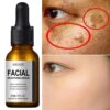 Powerful Dark Spots Remover Whitening Serum Face Freckle Melanin Correcting Anti Pigmentation Brighten Skin Beauty Care Products