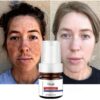 Powerful Spot-removing Whiten Serum Cream Vitamin C Skin Brighten Essence Removal Melasma Dark Spots Moisturize Beauty Skin Care