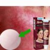 Facial Redness Cream Instant Spider Vein Remove Sensitive Skin Sooth Anti Redness Rosacea Treat Lotion Korean Cosmetics