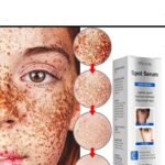Freckle Removal Whitening Essence Liquid Decompose Melanin Fade Dark Spots Melasma Treatment Brighten Improve Dull Skin