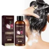 Rosemary Biotin Shampoo Hair Growth Thickening Anti Loss Strengthening Root Oil Control Deep Cleansing Volumizing Shampoo