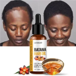 Naturals Batana Oil Fast Hair Growth for Men Women Pure Batana Oil Nourish Shiny Hair Healthy Hair Care Anti Hair Loss