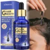 Hair Growth Serum Anti Hair Loss Treatment Follicle Activator Density Booster Scalp Root Care Oil Thinning Hair Men Women