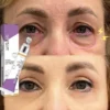 Brightening Eye Cream with Retinol | Lightweight Hydrating Eye Care Retinol Eye Care Cream Refreshed Appearance