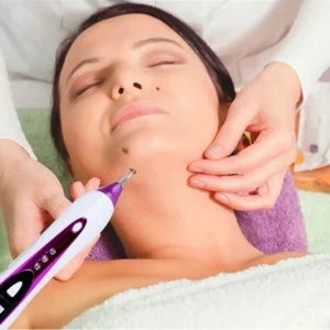 Professional Skin Tag Remover Plasma Pen Freckle Mole Warts Removal Lcd Nevus Tattoo Black Spots Remover Blemish Removal Pen