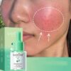Asiatic Centella Face Serum Reduce Facial Redness Lifting Firming Faded Wrinkles Whitening Facial Essence Skin Care Product
