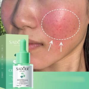 Asiatic Centella Face Serum Reduce Facial Redness Lifting Firming Faded Wrinkles Whitening Facial Essence Skin Care Product